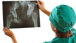 diagnóstico instrumental de artrosis de la articulación de la cadera