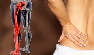 Características del dolor de espalda. 