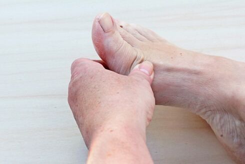 artrosis del pie