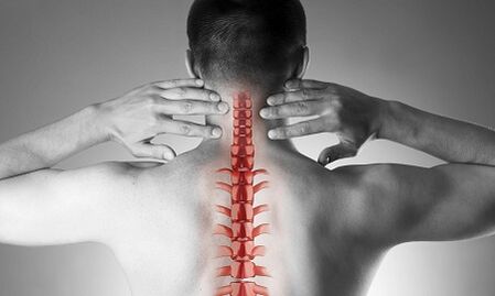¿Cómo se manifiesta la osteocondrosis de la columna cervical