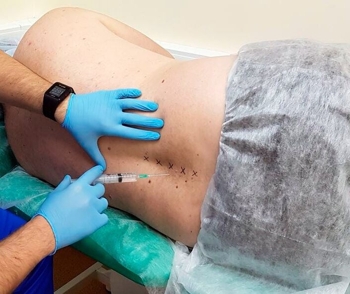 bloqueos medicinales para la espalda